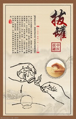 中医拔罐理疗展板